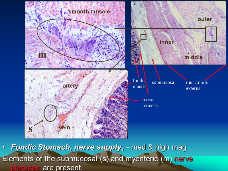 Fundic Stomach, nerve supply, - med & high mag  Elements of the submucosal